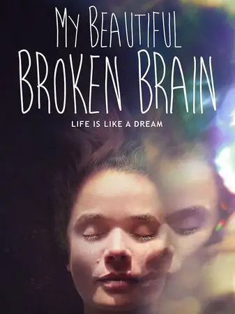 Phim Khối óc xinh đẹp tội nghiệp của tôi - My Beautiful Broken Brain (2016)