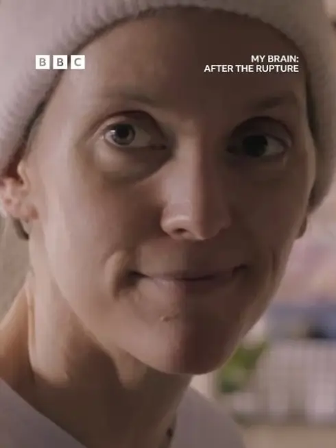  My Brain: After the Rupture (2025)